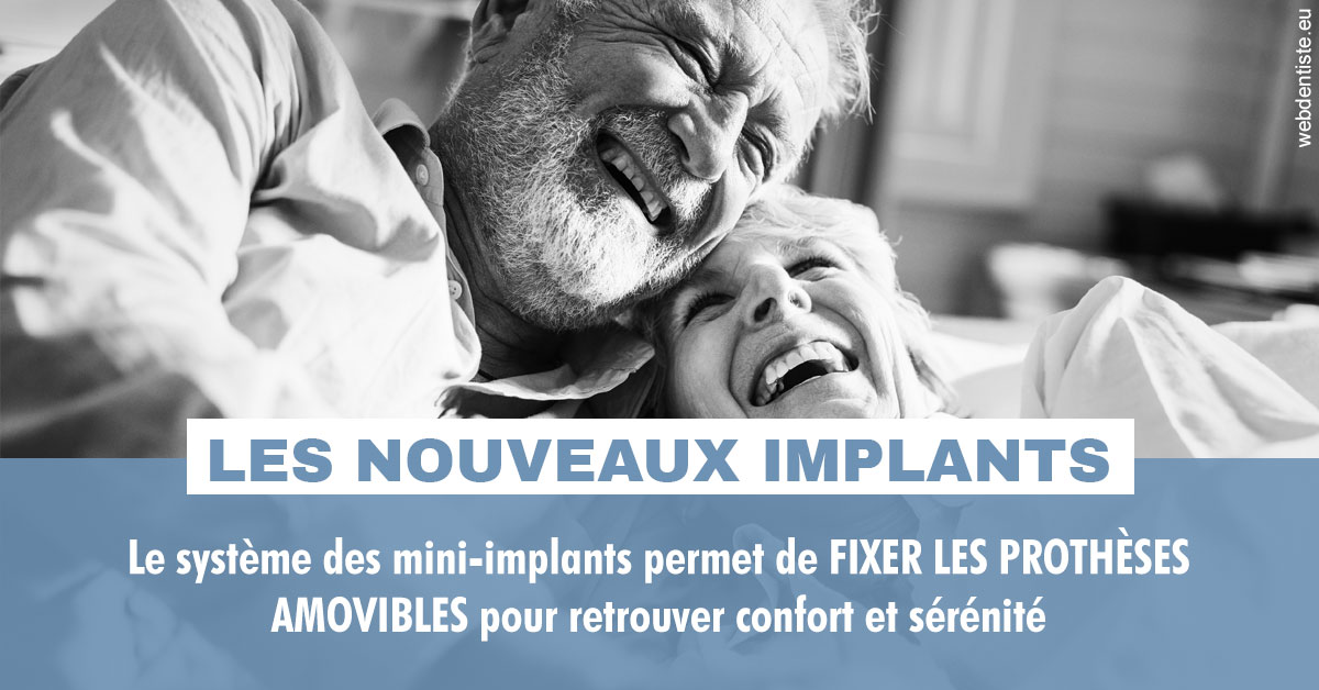 https://selarl-dr-rapoport.chirurgiens-dentistes.fr/Les nouveaux implants 2