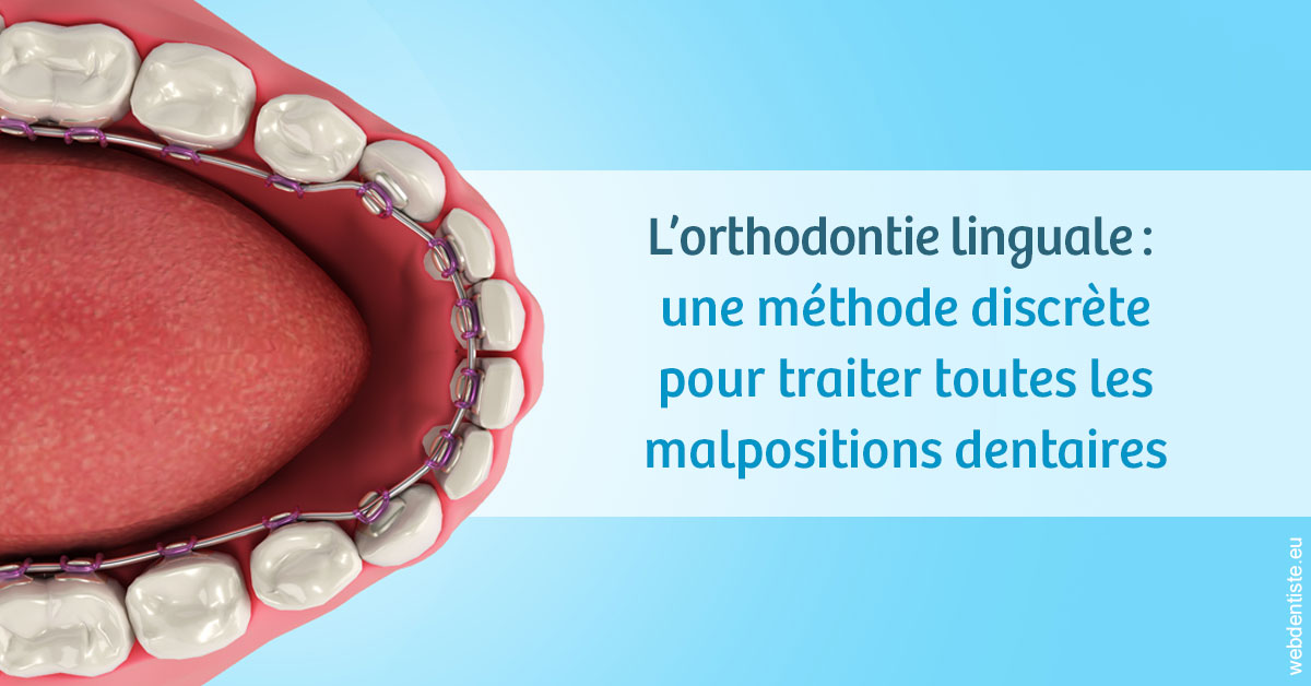 https://selarl-dr-rapoport.chirurgiens-dentistes.fr/L'orthodontie linguale 1