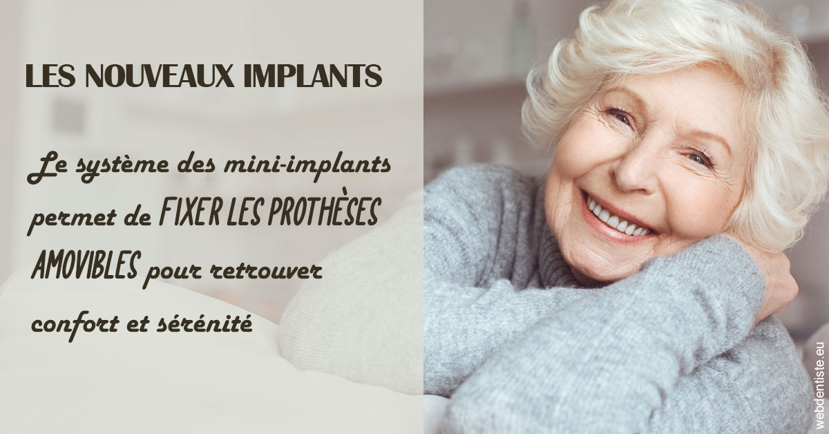 https://selarl-dr-rapoport.chirurgiens-dentistes.fr/Les nouveaux implants 1