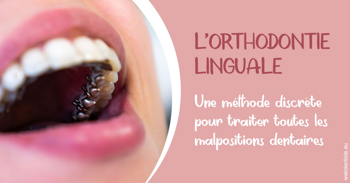 https://selarl-dr-rapoport.chirurgiens-dentistes.fr/L'orthodontie linguale 2