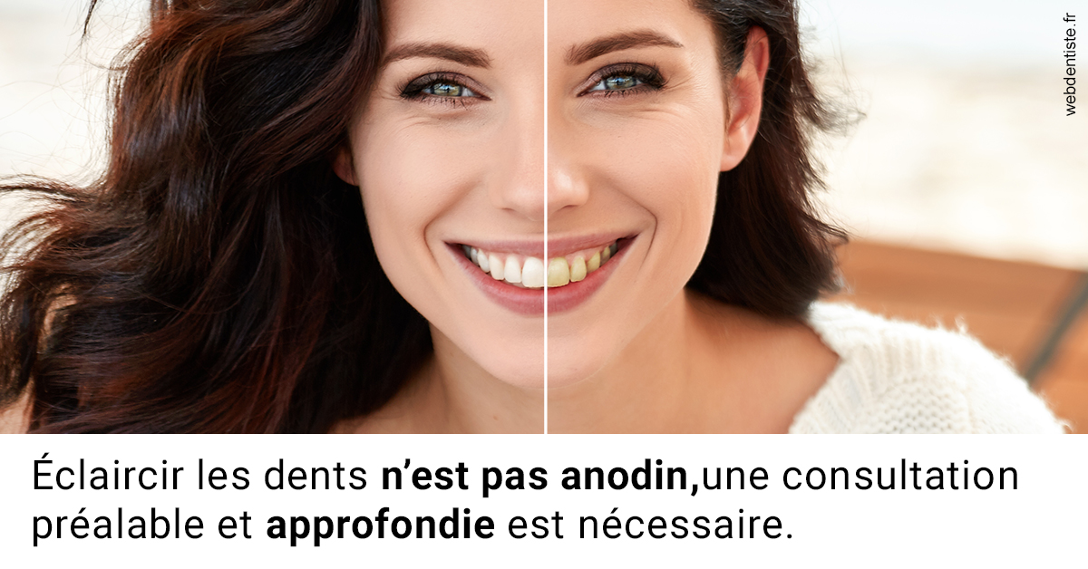 https://selarl-dr-rapoport.chirurgiens-dentistes.fr/Le blanchiment 2