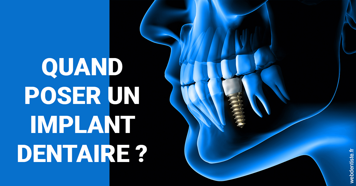 https://selarl-dr-rapoport.chirurgiens-dentistes.fr/Les implants 1
