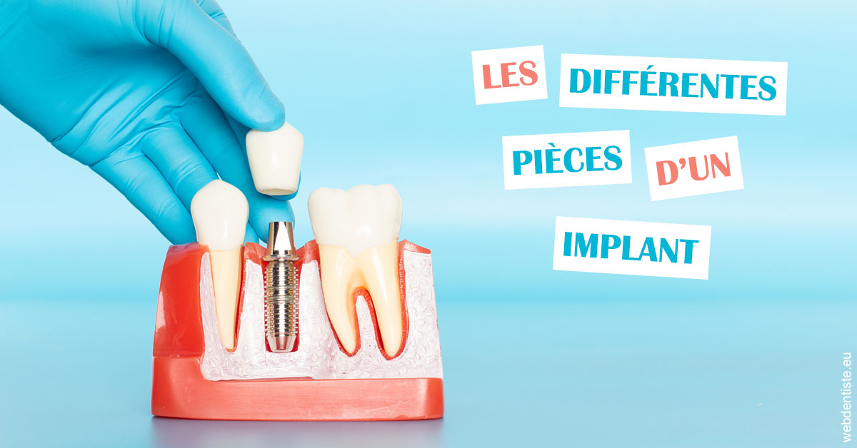 https://selarl-dr-rapoport.chirurgiens-dentistes.fr/Les différentes pièces d’un implant 2