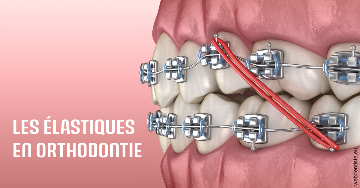 https://selarl-dr-rapoport.chirurgiens-dentistes.fr/Elastiques orthodontie 2
