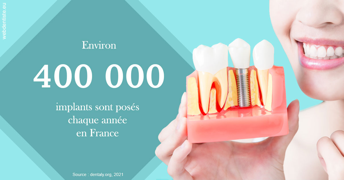 https://selarl-dr-rapoport.chirurgiens-dentistes.fr/Pose d'implants en France 2